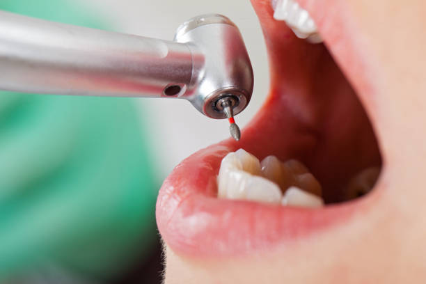 Best Emergency Denture Repair in Prosperity, WV